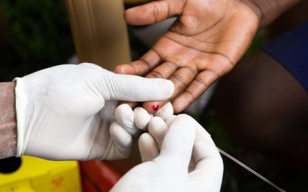 Malaria is on the rise in southern Africa, with several countries – including Botswana, eSwatini, Namibia and Zimbabwe – reporting new outbreaks, underscoring the ongoing challenges in eradicating the disease in Africa.